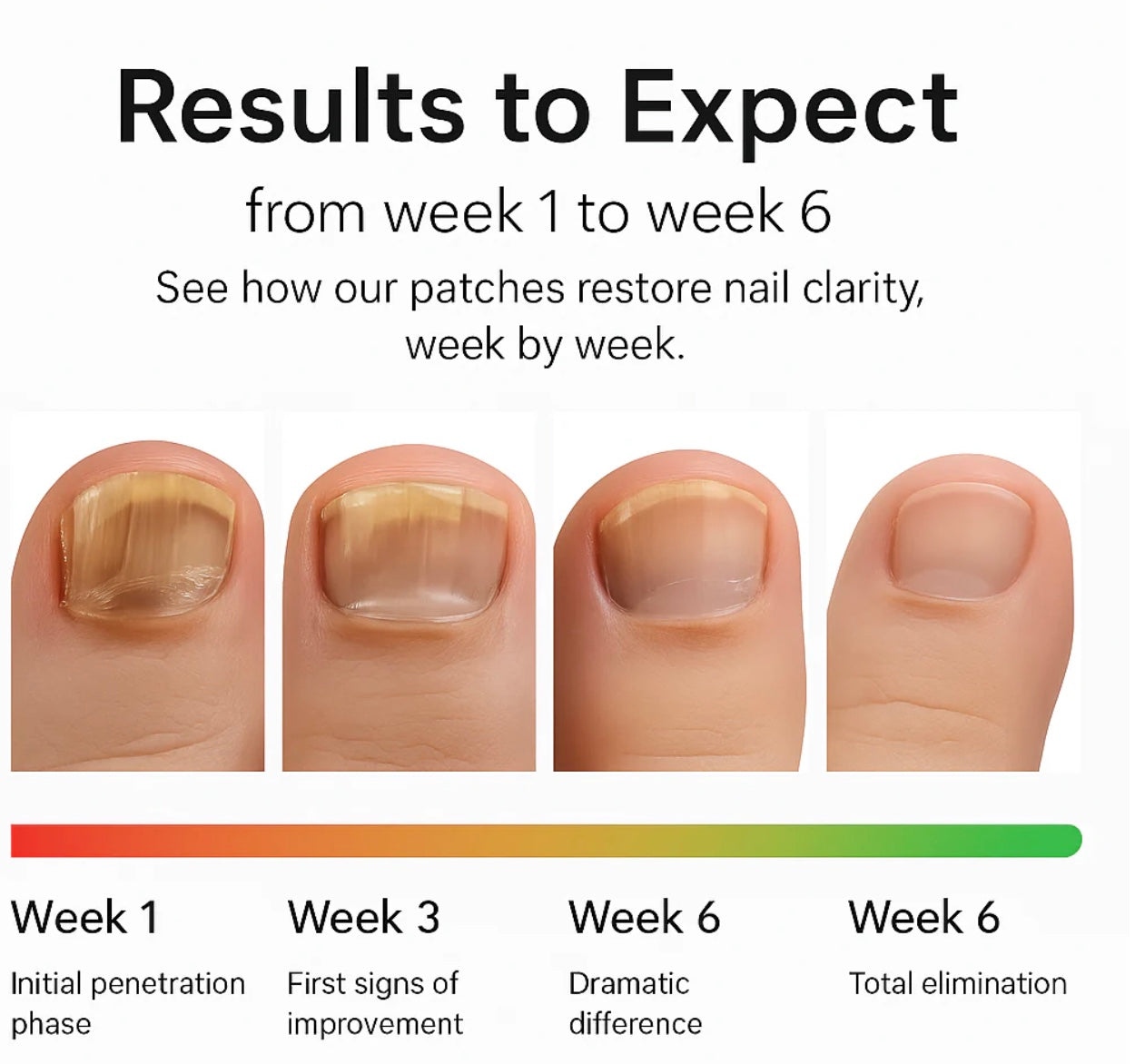 Vurexa Fungal Nail Repair Patch