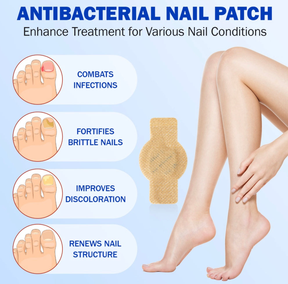 Vurexa Fungal Nail Repair Patch